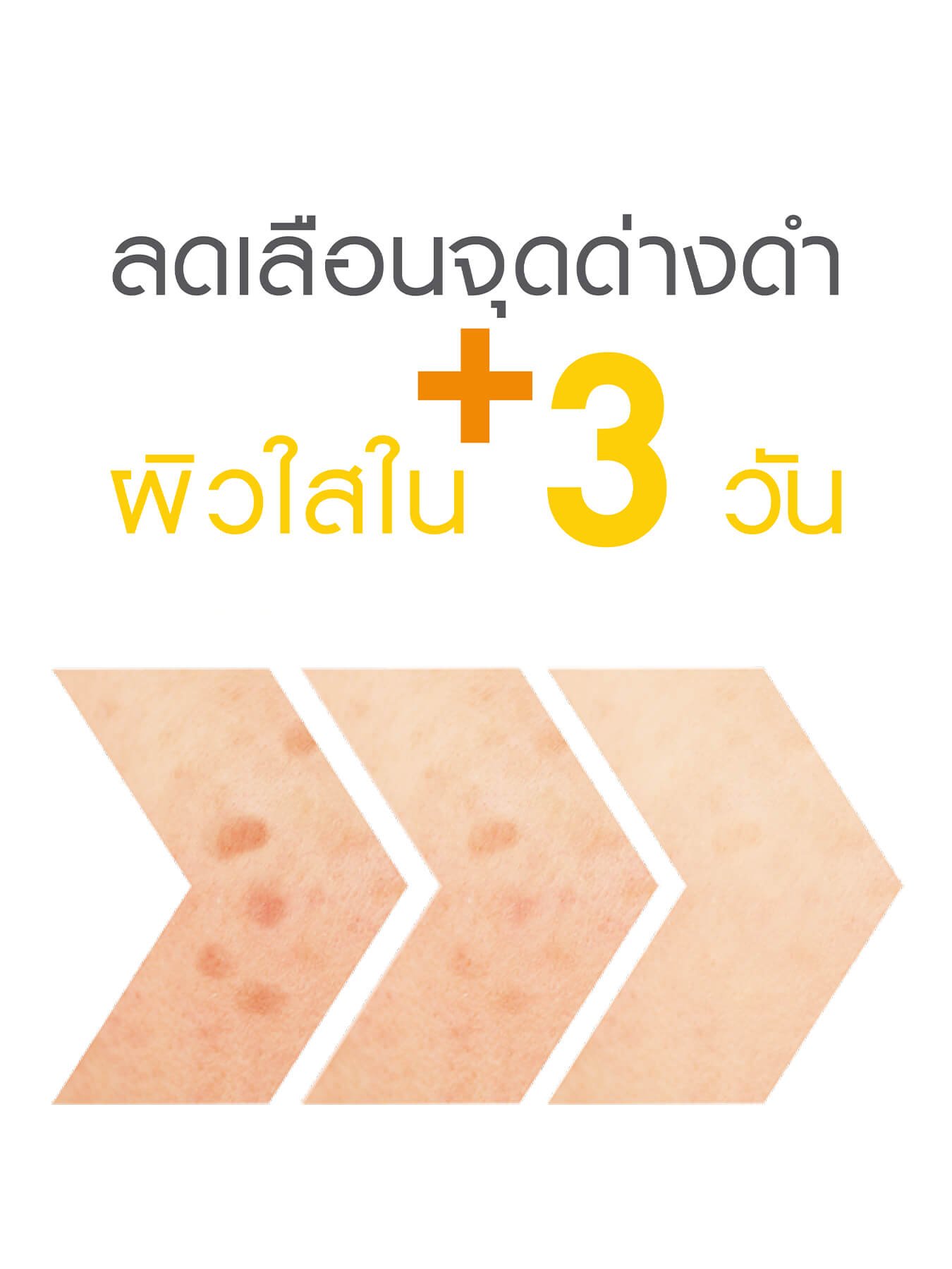 รักษาจุดด่างดำ เซรั่มหน้าใสเซเว่น